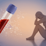 慢性疲労症候群の「見えない病気」を可視化、エピジェネティクス技術で診断へ前進