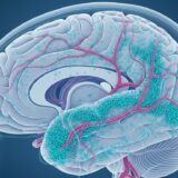 目に見えなかったリスクを早期化──マイクロプラスチックが血管性認知症に関与する可能性