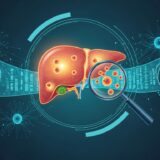 MAOSS|アリババのAIが非造影CTと血清データで脂肪性肝疾患を機会的スクリーニング